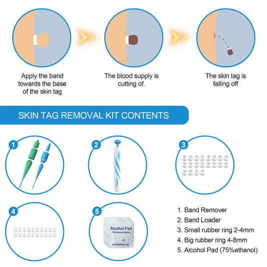ClearSkin — Skin Tag & Mole Remover Kit